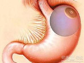 胃下垂可以吃蒲瓜吗视频